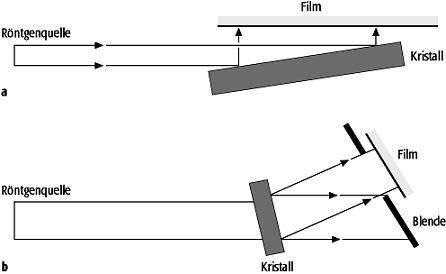 Röntgen-Topographie